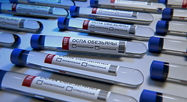 Как лечится оспа обезьян?
