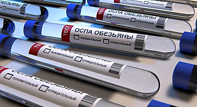 Тест-системы на выявление оспы обезьян