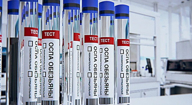 Тест-системы для выявления оспы обезьян