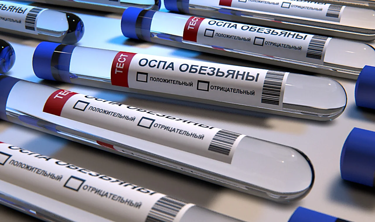 Тест-системы на выявление оспы обезьян