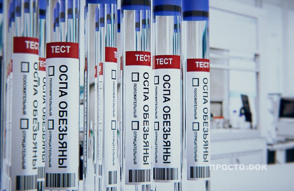 Система тестирования на выявление оспы обезьян